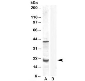 Western blot testing of human prostate lysate with GPX7 antibody at 0.3ug/ml with [B] and without [A] blocking/immunizing peptide. The expected ~20 kDa band and the additional ~40 kDa band are both blocked by the immunizing peptide.
