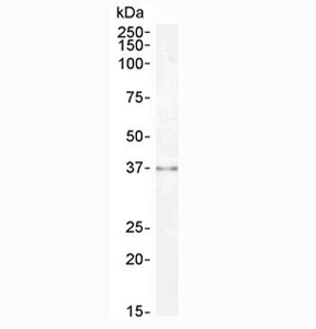 Western blot testing of human kidney lysate with Sprouty antibody at 0.3ug/ml. Predicted molecular weight ~35 kDa.
