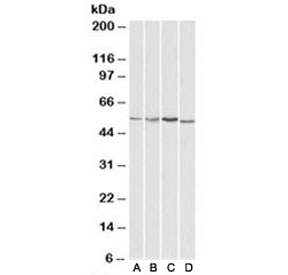 Western blot testing of HepG2 [A], Jurkat [B], mouse brain [C] and rat brain [D] lysates with AKT3 antibody at 1ug/ml. Predicted molecular weight: ~56kDa but can be observed from 60~65kDa.