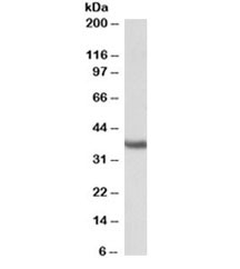 Western blot testing of mouse testis lysate with Clusterin antibody at 0.3ug/ml. Predicted molecular weight: 75-80kDa (heterodimer precursor), 36-39kDa (alpha subunit), 34-36kDa (beta subunit).
