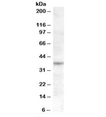 Western blot testing of Jurkat cell lysate with RASSF7 antibody at 1ug/ml. Predicted molecular weight: ~40kDa.