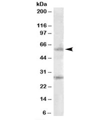 Western blot testing of Daudi lysate with SOCS7 antibody at 1ug/ml. The expected ~60kDa band and the additional ~28kDa band are both blocked by the immunizing peptide.