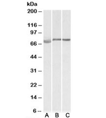 Western blot testing of human [A], mouse [B] and rat [C] testis lysate with DMTF1 antibody at 1ug/ml. Predicted molecular weight: ~84/75kDa (isoforms a/b).