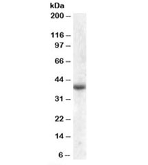 Western blot testing of human skeletal muscle lysate with APOL6 antibody at 2ug/ml. Predicted molecular weight: ~38kDa.