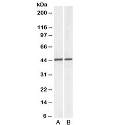 Western blot testing of mouse [A] and rat [B] liver lysate with ACAT1 antibody at 0.1ug/ml. Predicted molecular weight: ~45kDa.