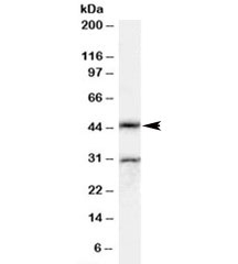 Western blot testing of rat testis lysate with Actl7b antibody at 0.5ug/ml. The expected ~45kDa band and the additional ~30kDa band are both blocked by the immunizing peptide.
