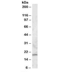 Western blot testing of peripheral blood mononucleocyte lysate with RGS13 antibody at 0.5ug/ml. Predicted molecular weight: ~19kDa.