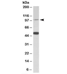Western blot testing of human cerebellum lysate with PTCHD1 antibody at 0.5ug/ml. The expected ~100kDa band and the additional ~50kDa band are both blocked by the immunizing peptide.