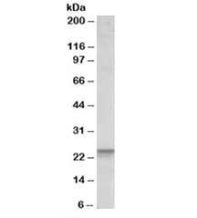 Western blot testing of peripheral blood lymphocyte lysate with BBC3 antibody at 0.1ug/ml. Predicted molecular weight: ~26kDa.