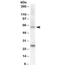 Western blot testing of mouse heart lysate with COL4A3BP antibody at 0.5ug/ml. Predicted molecular weight: ~70kDa, observed here at ~60kDa. Both observed bands are blocked by the immunizing peptide.