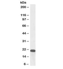 Western blot testing of human kidney lysate with biotinylated UXT antibody at 0.3ug/ml. Predicted molecular weight: ~20kDa.