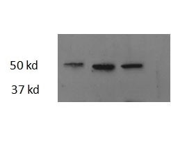 Western blot testing of three different zebrafish adult heart lysate samples with Thrb antibody at 2.5ug/ml. Predicted molecular weight: ~44kDa.