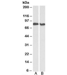 Western blot testing of human placenta [A] and rat brain [B] lysates with PRKCB antibody at 0.3ug/ml. Predicted molecular weight: ~77 kDa.