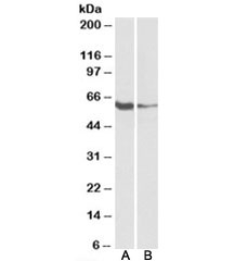 Western blot testing of human tonsil [A] and Daudi [B] lysates with FCRL2 antibody at 1ug/ml. Predicted molecular weight: ~56kDa.