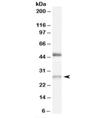 Western blot testing of human kidney lysate with BNIP1 antibody at 0.5ug/ml. Predicted molecular weight: ~26kDa. Both bands are both blocked by the immunizing peptide.