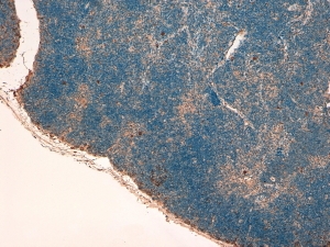 IHC testing of FFPE mouse thymus with STAT3 antibody at 4ug/ml. HIER: steamed with pH9 Tris/EDTA buffer, HRP-staining.