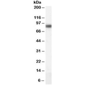 Western blot testing of human liver lysate with CPT1A antibody at 0.1ug/ml. Predicted molecular weight ~86 kDa.