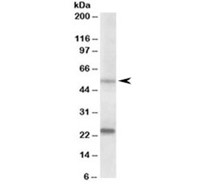Western blot testing of human prostate lysate with MMP3 antibody at 0.2ug/ml. Molecular weight: the expected ~54 kDa band and the additional ~24kDa band are both blocked by the immunizing peptide.