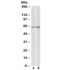 Western blot testing of albumin-depleted serum [A] and plasma [B] lysates with alpha-1-Antichymotrypsin antibody at 0.3ug/ml. Predicted molecular weight: 47/65kDa (unmodified/glycosylated).