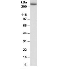 Western blot testing of human peripheral blood lymphocyte lysate with MYH9 antibody at 0.3ug/ml. Predicted molecular weight: ~227kDa.