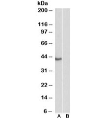 Western blot testing of HeLa nuclear [A] and cytosolic [B] lysate with TBP antibody at 0.3ug/ml. Predicted molecular weight ~38kDa.