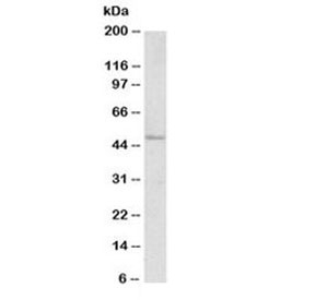 Western blot testing of human ovary lysate with FOXL2 antibody at 1ug/ml. Predicted molecular weight ~38 kDa, but can be observed at 45-50 kDa.