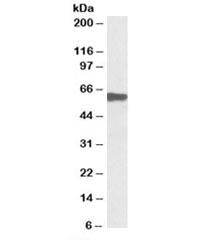 Western blot testing of human skeletal muscle lysate with Myotilin antibody at 0.1ug/ml. Predicted molecular weight: ~55/35kDa (isoforms 1/2).