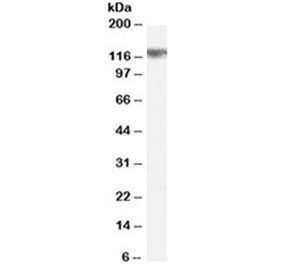 Western blot testing of rat brain lysate with Cyld antibody at 0.5ug/ml. Predicted molecular weight ~107 kDa, observed here at ~125 kDa.