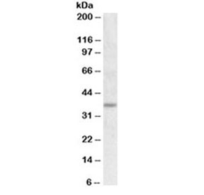 Western blot testing of rat adipose lysate with UCP2 antibody at 1ug/ml. Predicted molecular weight ~34 kDa.