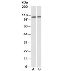 Western blot testing of human heart [A] and kidney [B] lysates with BMP antibody at 1ug/ml. Predicted molecular weight: ~111 kDa.