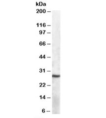 Western blot testing of mouse spleen lysate with APOBEC1 antibody at 1ug/ml. Predicted molecular weight: ~28kDa.