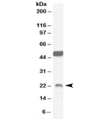 Western blot testing of mouse brain lysate with Neurturin antibody at 0.1ug/ml. The expected ~23kDa band and the additional ~50kDa band are both blocked by the immunizing peptide.