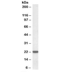 Western blot testing of human liver lysate with LMP7 antibody at 0.01ug/ml. Western blot testing of human liver lysate with LMP7 antibody at 0.01ug/ml. Predicted molecular weight: ~30kDa but can be observed at ~22kDa (PMID: 10878350).