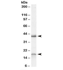 Western blot testing of rat brain lysate with Ramp1 antibody at 0.3ug/ml. Routinely observed at ~18kDa and 40kDa.