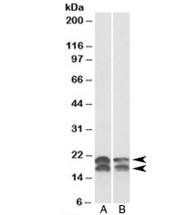 Western blot testing of A549 [A] and HeLa [B] lysates with NME1 antibody at 0.01ug/ml. Predicted molecular weight: ~20/17kDa (isoforms a/b).