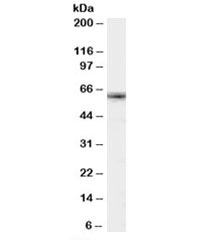 Western blot testing of K562 cell lysate with FOXO4 antibody at 1ug/ml. Predicted/observed molecular weight: ~54/60-65kDa.