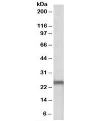 Western blot testing of mouse heart lysate with NDUFS8 antibody at 0.1ug/ml. Predicted molecular weight: ~24kDa.