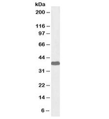 Western blot testing of human cerebellum lysate with biotinylated Laforin antibody at 1ug/ml. Predicted molecular weight: ~37kDa.