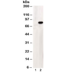 Western blot testing of HEK293 lysate overexpressing human ABCD1 and probed with ABCD1 antibody at 1ug/ml (mock transfection in lane 1). The predicted molecular weight is ~83kDa which is observed in transfected lysate but human brain lysate shows a 50kDa band.
