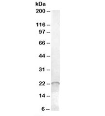 Western blot testing of Jurkat cell lysate with ASF1A antibody at 0.01ug/ml. Predicted molecular weight: ~23kDa.
