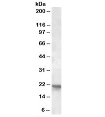 Western blot testing of human cerebellum lysate with POLR2G antibody at 2ug/ml. Predicted molecular weight: ~19kDa.