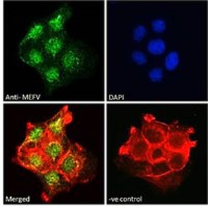 IF/ICC staining of fixed and permeabilized human A431 cells with GADD34 antibody (green) at 10ug/ml, DAPI nuclear stain (blue) and phalloidin (red).