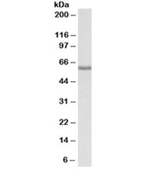 Western blot testing of human liver lysate with Fibrinogen beta chain antibody at 0.01ug/ml. Predicted molecular weight ~56kDa.