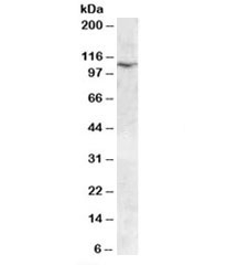 Western blot testing of human placenta lysate with TRPC6 antibody at 0.03ug/ml. Predicted molecular weight: ~106 kDa.