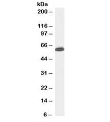 Western blot testing of Jurkat lysate with Nup50 antibody at 0.5ug/ml. Predicted molecular weight: observed at ~50 or ~60kDa.