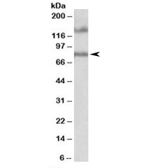 Western blot testing of human hippocampus lysate with EPB41L5 antibody at 1ug/ml. The expected ~80 kDa band and the additional ~140 kDa band are both blocked by the immunizing peptide.
