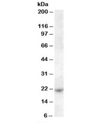 Western blot testing of Jurkat cell lysate with ASF1A antibody at 1ug/ml. Predicted molecular weight: ~23kDa.
