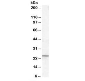 Western blot testing of human kidney lysate with PGRMC1 antibody at 0.1ug/ml. Predicted molecular weight: ~22 kDa.