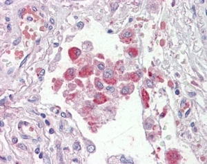 IHC testing of FFPE human lung with OSBPL9 antibody at 2.5ug/ml. HIER: steamed with pH6 citrate buffer, AP-staining.