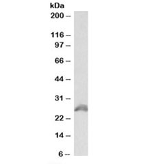 Western blot testing of HEK293 lysate with HOXB6 antibody at 1ug/ml. Predicted molecular weight: ~25kDa.